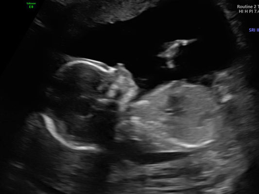 ~14 Week+ Gender~ $85
