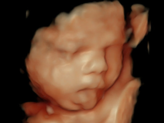 ~Quick Peek 24 + Weeks~ $85